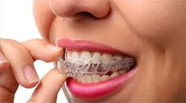 Fountain View Family Dental Invisalign